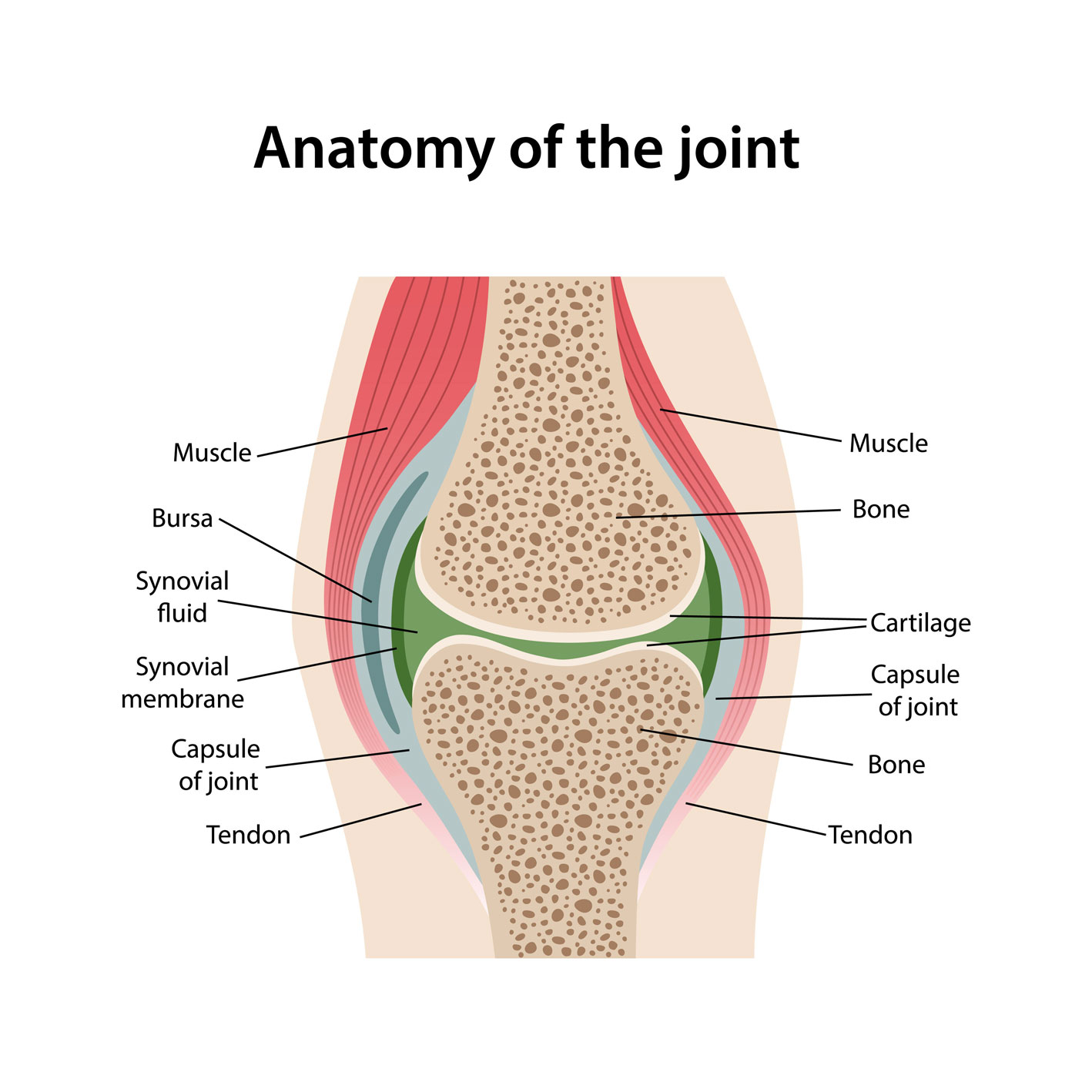 Depiction of joint anatomy: muscle, bursa, synovial fluid, synovial membrane, capsule of joint, tendon.